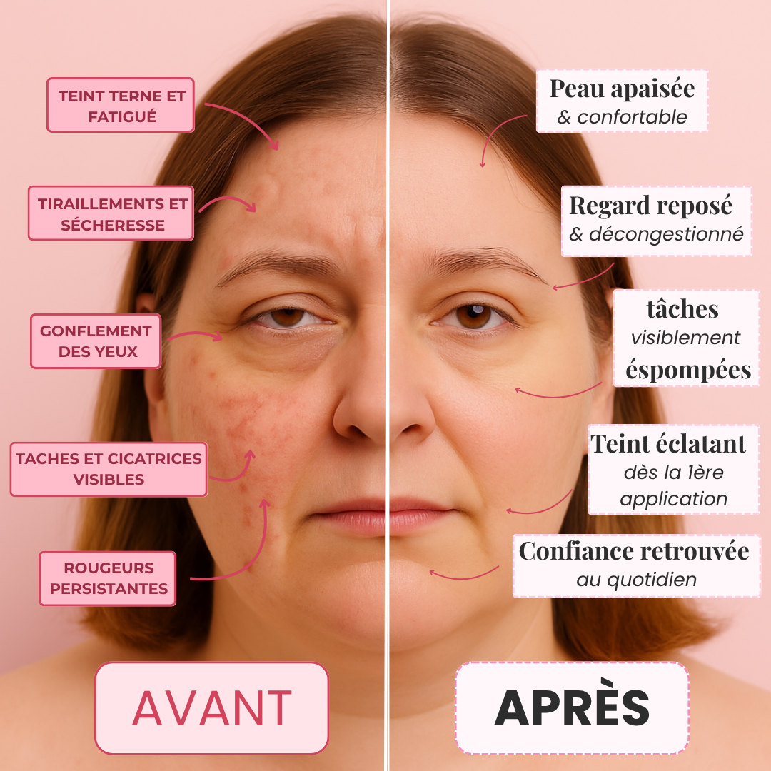 ReviveMask au PDRN – Soin cellulaire anti-imperfections